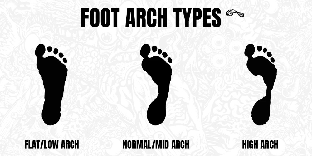 foot arch type